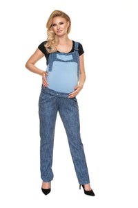 Overall model 159436